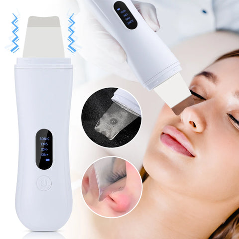 UltraCleanse™ Pro – Ultrasonic Skin Scrubber & Pore Cleaner